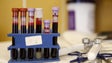 Imagem de Novo teste sanguíneo deteta 8 tipos de cancro