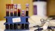 Novo teste sanguíneo deteta 8 tipos de cancro