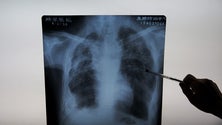 Imagem de Vírus já matou 45.719 pessoas e infetou mais de 900 mil em todo o mundo