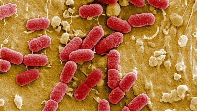 Imagem de Mau uso de antibióticos potencia aparecimento de superbactérias – OMS
