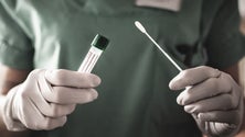 Imagem de Portugal doa 60 mil testes