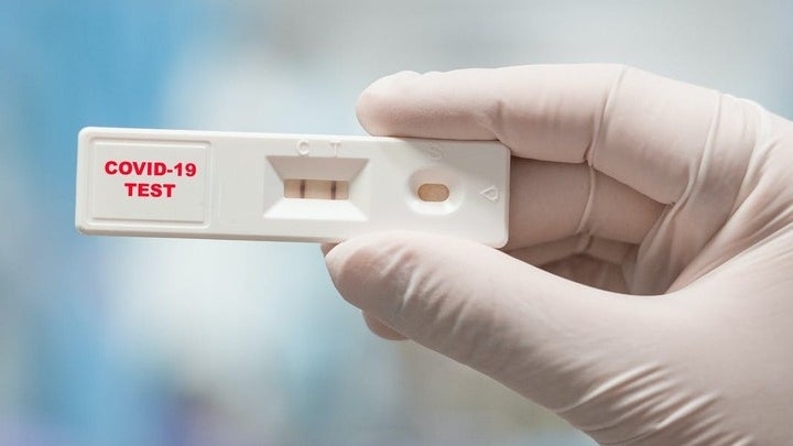 Imagem de UE atualiza lista de testes rápidos