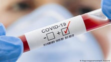 Imagem de Covid-19: Portugal com mais um morto e mais 377 casos confirmados
