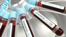 Imagem de Covid-19: Mais de 406 mil mortos e 7,1 milhões infetados em todo mundo