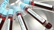 Imagem de Covid-19: Mais de 406 mil mortos e 7,1 milhões infetados em todo mundo