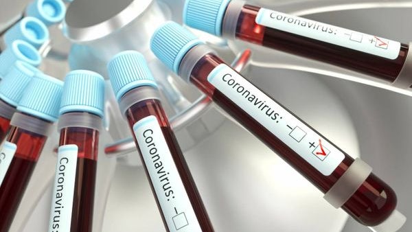 Imagem de Covid-19: Mais de 406 mil mortos e 7,1 milhões infetados em todo mundo