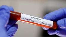 Imagem de Covid-19: Sobe para seis o número de casos positivos na Madeira (Vídeo)