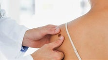 Imagem de Madeira promove rastreios gratuitos no Dia do Euromelanoma