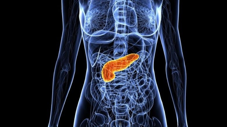 Imagem de Movimento mundial alerta para o cancro do pâncreas