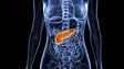 Movimento mundial alerta para o cancro do pâncreas