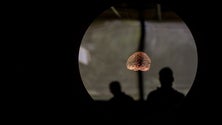 Imagem de Centro Hospitalar de Coimbra com tratamento cerebral pioneiro