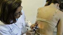 Mais de 40 serviços participam 4.ª feira no rastreio nacional do Dia do Euromelanoma