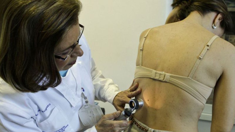 Imagem de Mais de 40 serviços participam 4.ª feira no rastreio nacional do Dia do Euromelanoma