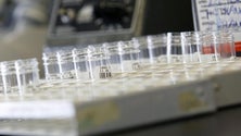 Imagem de Descoberto novo mecanismo da infeção pela bactéria Salmonella