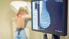 Imagem de Portugal ultrapassa objetivo europeu de convidar 90% da população-alvo para rastreio do cancro da mama
