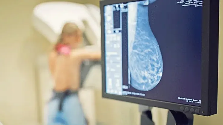 Portugal ultrapassa objetivo europeu de convidar 90% da população-alvo para rastreio do cancro da mama