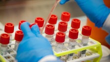 Imagem de Covid-19: Médicos podem usar medicamentos do ébola e malária em doentes internados