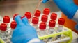Imagem de Covid-19: Médicos podem usar medicamentos do ébola e malária em doentes internados
