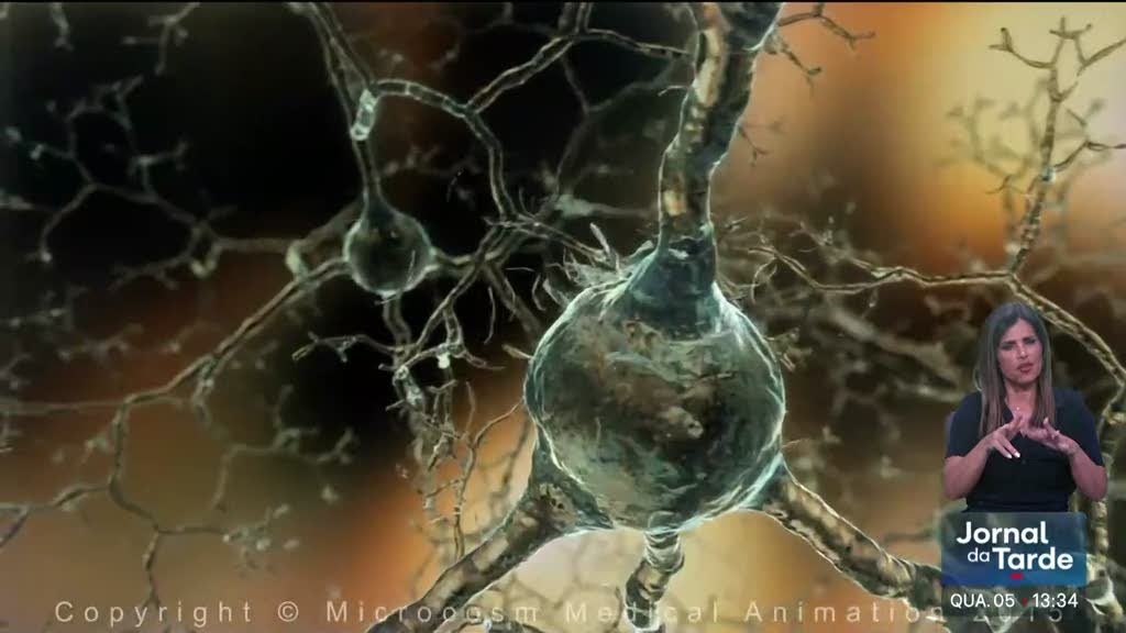 Alzheimer com diagnóstico simples e rápido com teste ao sangue