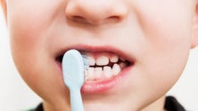 JPP pede mais médicos dentistas para a saúde oral infantil