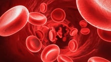 Imagem de Principal desafio da anemia é conhecer as causas (Vídeo)