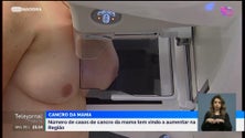 Imagem de Número de casos de cancro da mama tem vindo a aumentar na Região (vídeo)