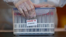 Imagem de Covid-19: Mais 58 mortes e 2.093 novos casos
