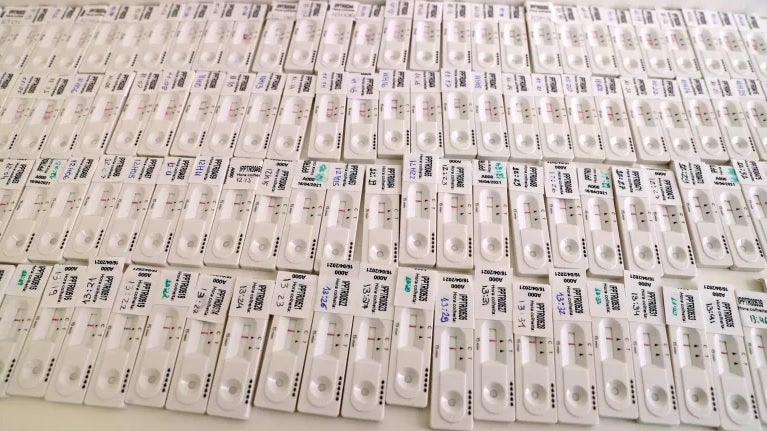Imagem de Incidência e índice de transmissibilidade continuam a baixar