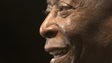 Imagem de Pelé a recuperar bem da operação