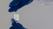 Imagem de Investigadores procuram marcadores que tornam pessoas susceptíveis ou resistentes à infeção