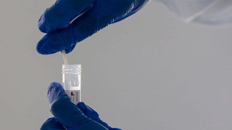 Imagem de Investigadores procuram marcadores que tornam pessoas susceptíveis ou resistentes à infeção