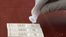 Imagem de 9,8 milhões para testes rápidos nas escolas e no setor social