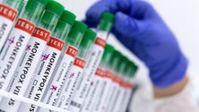 Imagem de Monkeypox: Número de infeções em Portugal sobe para 770