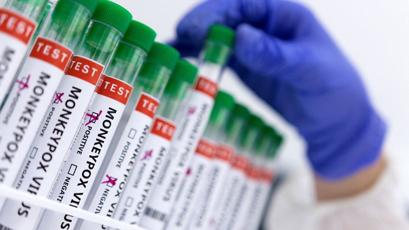 Imagem de Monkeypox: Número de infeções em Portugal sobe para 770