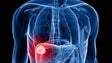 Imagem de Primeiro caso de `hepatite A` detetado na Madeira