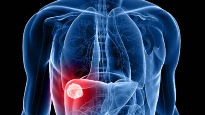 Imagem de Primeiro caso de `hepatite A` detetado na Madeira