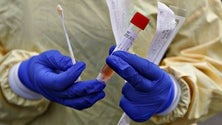 Imagem de Covid-19: Albuquerque espera receber 10 mil testes dos EUA na próxima semana