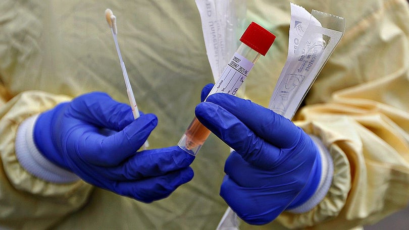 Imagem de Covid-19: Albuquerque espera receber 10 mil testes dos EUA na próxima semana