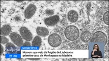 Madeira registou hoje o primeiro caso de Monkeypox (vídeo)