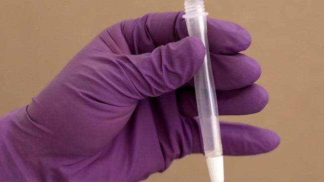 Imagem de Cientistas descobrem como evitar que Coronavírus infete outras células