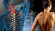`Esclerose Múltipla` atinge 112 pessoas na Madeira