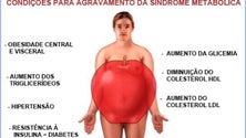 Imagem de Estudo indica que a síndrome metabólica afeta entre 36,5 e 49,6% dos portugueses