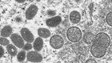 Imagem de Portugal com 23 casos confirmados de infeção pelo vírus Monkeypox