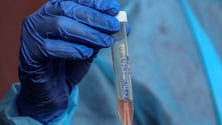 Imagem de Covid-19: EUA registam 355 mortos e mais de 42 mil infetados nas últimas 24 horas