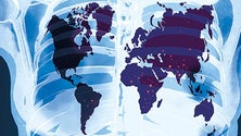 Imagem de Variante Delta duplica risco de internamento