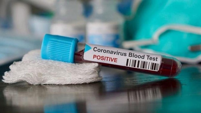 Imagem de Covid-19: Portugal com mais 95 mortes
