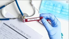 Imagem de Covid-19: Vírus matou mais de 512 mil pessoas e infetou mais de 10,5 milhões no mundo