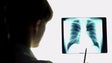 Taxa de prevalência da tuberculose na Madeira é a mais baixa do país (áudio)