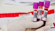Imagem de Governo Regional pede contenção nas análises de sangue