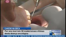 Por ano morrem 30 madeirenses vítimas de cancro na boca (Vídeo)